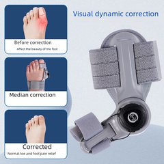 Upgraded Adjustable Bunion Corrector